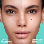 Resultados-del-corrector-facial-para-cuidar-tu-piel